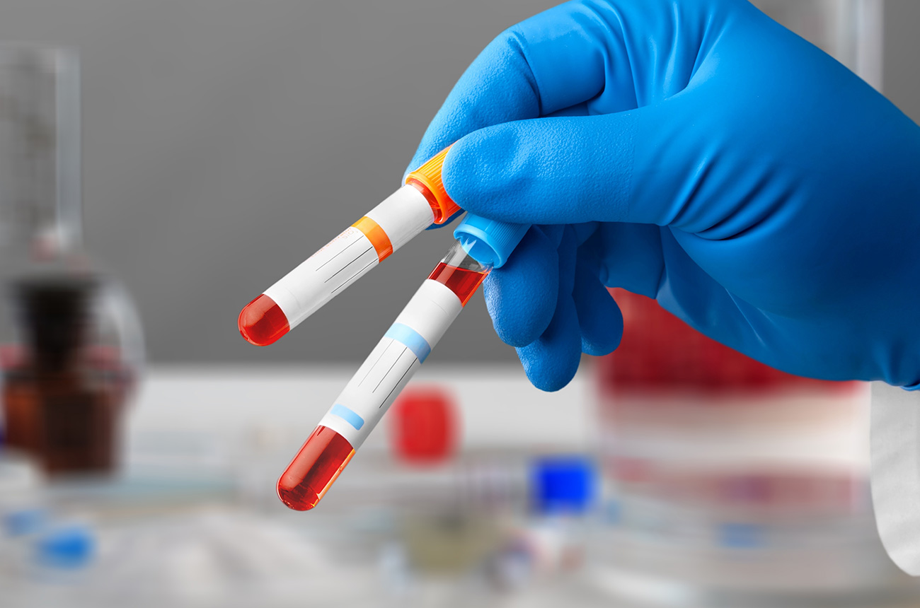 分子栄養採血と<br>食事相談外来<br>（自費診療）